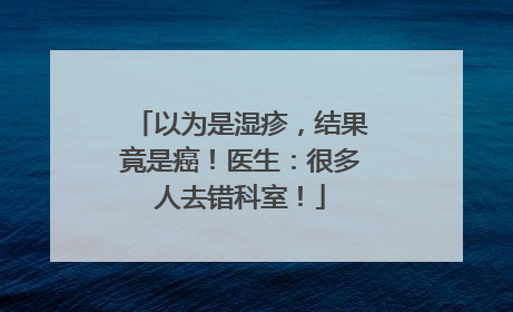 以为是湿疹，结果竟是癌！医生：很多人去错科室！